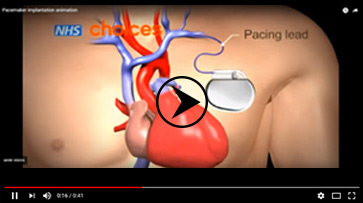 heart specialist in kolkata